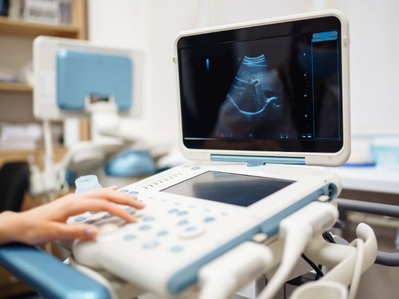 Ultrassonografia (USG)