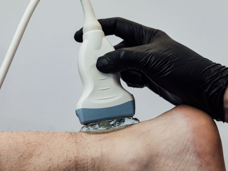 Ultrassom Tendão de Aquiles